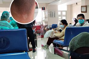 手臂有一個白斑是怎么回事